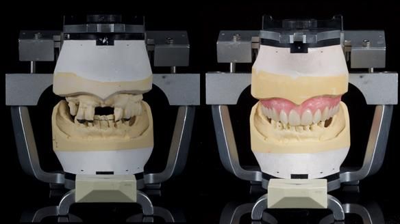 Newsletter 79 – Creating a wonderful smile and changing a life.