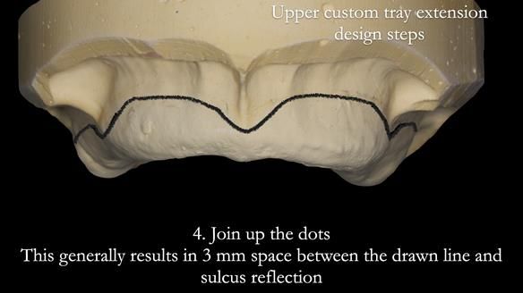 Newsletter 50 Special edition Complete Dentures FULL PROTOCOL