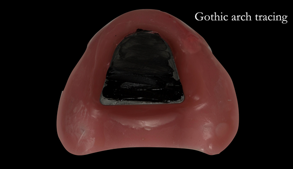 Figure 79 Chinagraph pencil application to allow tracing to scribe CR