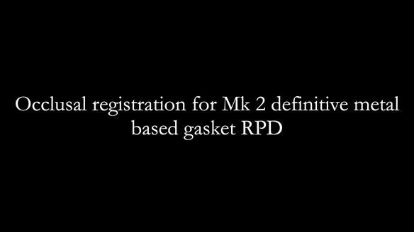 Newsletter 82 Mary - A complete upper and a one-tooth gasket denture