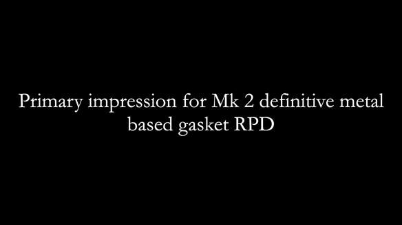 Newsletter 82 Mary - A complete upper and a one-tooth gasket denture