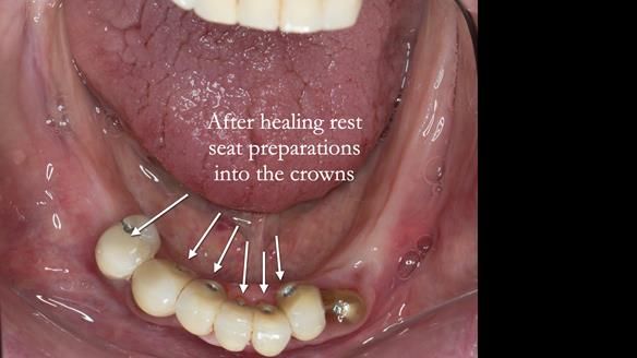 Ken – going downhill, first class