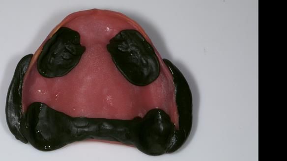 Newsletter 79 – Creating a wonderful smile and changing a life.