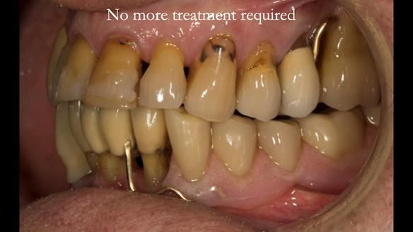 Ken – going downhill, first class