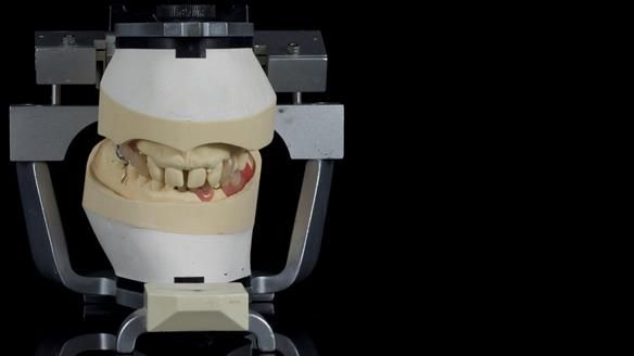 Newsletter 86 Peter the Architect — precision removable partial dentures case study