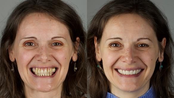 Newsletter 79 – Creating a wonderful smile and changing a life.