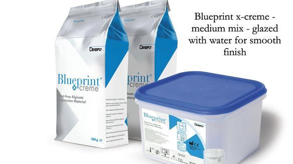 Newsletter 82 Mary - A complete upper and a one-tooth gasket denture