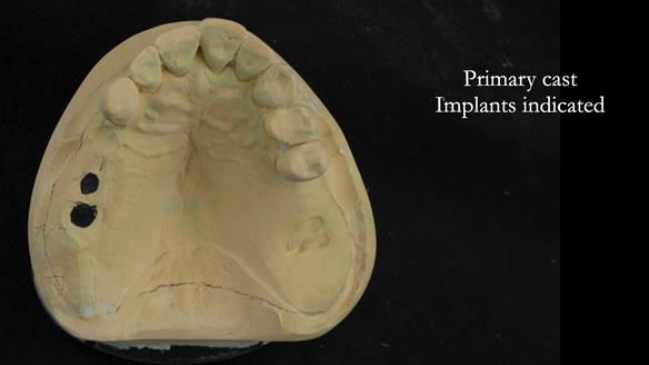 Ken – going downhill, first class