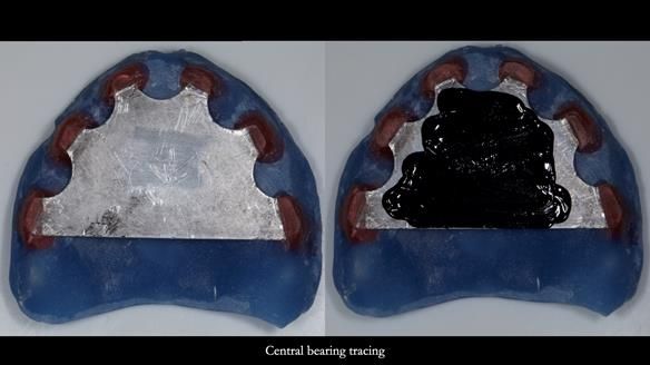 Newsletter 79 – Creating a wonderful smile and changing a life.