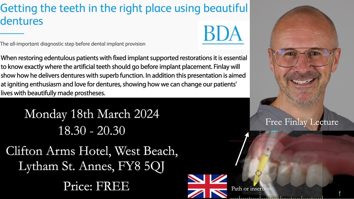 Finlay's Newsletter 61 provision of a lower unilateral free end saddle metal based partial denture for Joyce
