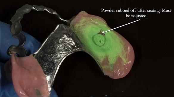 Ken – going downhill, first class