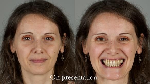 Newsletter 79 – Creating a wonderful smile and changing a life.