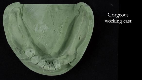 Ken – going downhill, first class