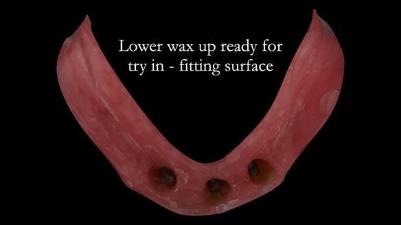 Wax try in ready for visit 4
