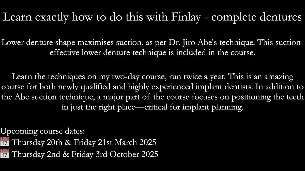 Newsletter 75: Marion’s case - Step-by-step complete denture workflow