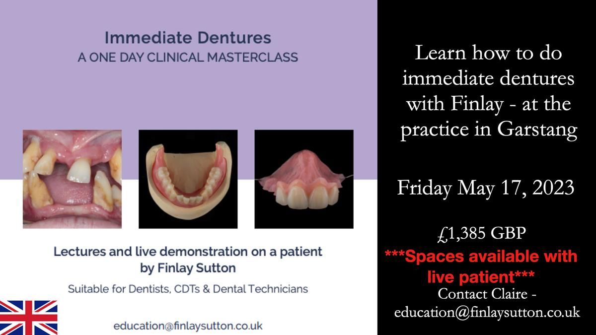 Finlay's Newsletter 63 Case study provision of metal based Scandinavian RPD - functional 10 years on