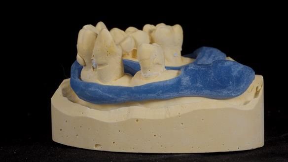 Newsletter 79 – Creating a wonderful smile and changing a life.