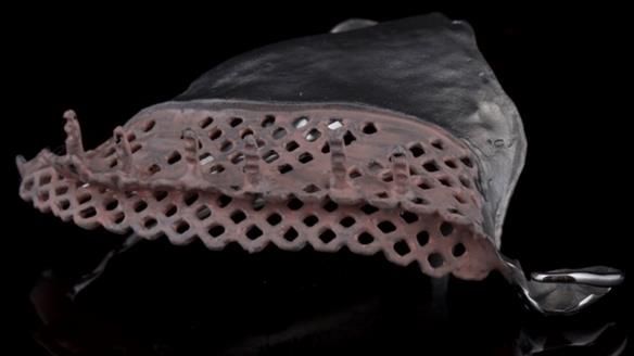 Upper metal base partial denture/occlusal stabilisation splint/obturator - full protocol