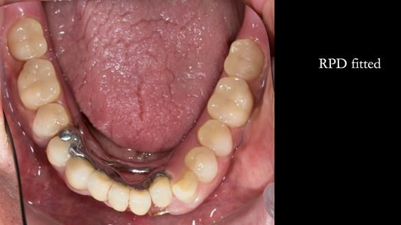 Ken – going downhill, first class