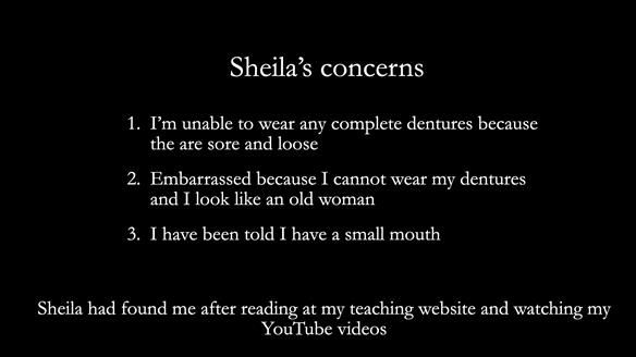 Newsletter 83: Sheila’s Complete Denture Success