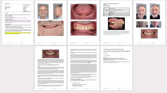 Newsletter 80 - Gordon’s dentures: the one case in 1,000 where my technique failed