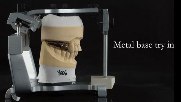 Ken – going downhill, first class