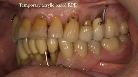 Ken – going downhill, first class