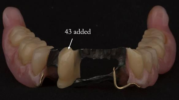 Ken – going downhill, first class