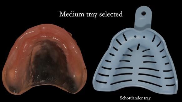 Upper tray - selected. Medium size - Schottlander tray