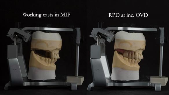 Ken – going downhill, first class