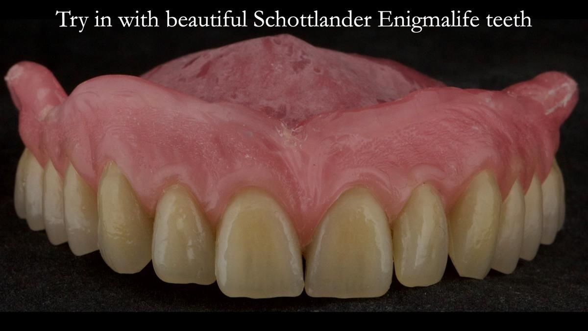 Newsletter 87 – Father Peter: A Partial Denture that needed Minor Miracle