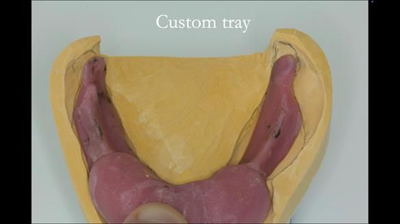 Ken – going downhill, first class