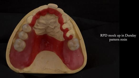 Ken – going downhill, first class