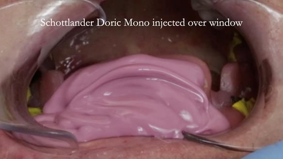 Ken – going downhill, first class