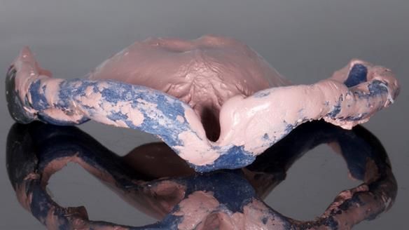 Newsletter 79 – Creating a wonderful smile and changing a life.