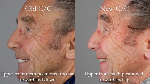 Newsletter 50 Special edition Complete Dentures FULL PROTOCOL