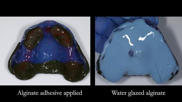 Newsletter 78: What do Clark Gable and a Locator® overdenture have in common?