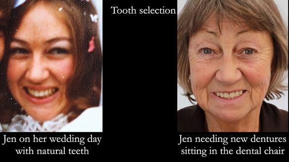Upper central incisor tooth size calculation formula - Next few slides are a different person to preserve Mary’s anonymity