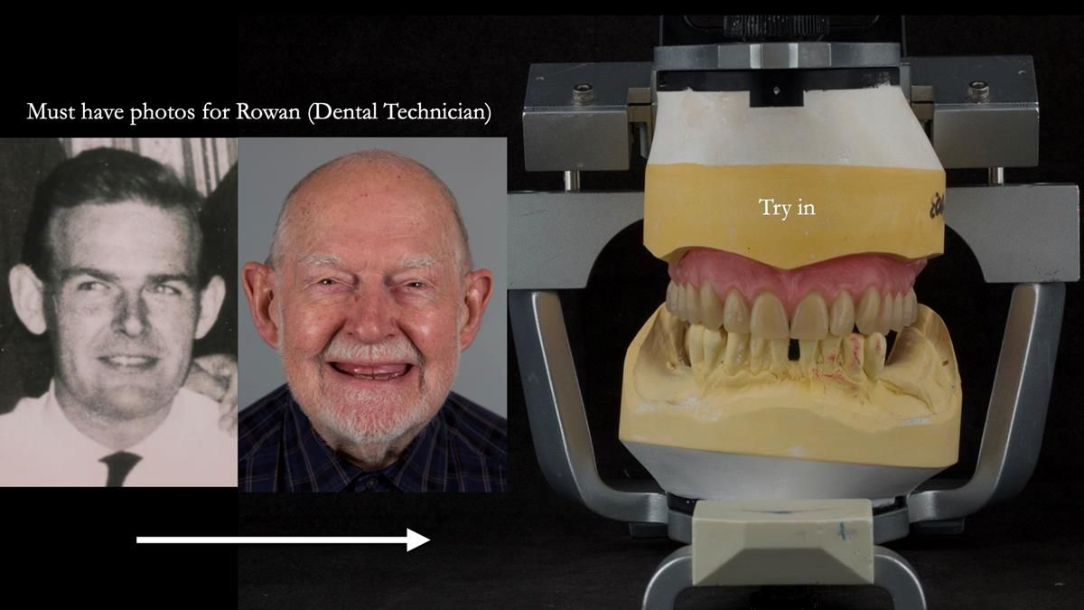 Newsletter 87 – Father Peter: A Partial Denture that needed Minor Miracle