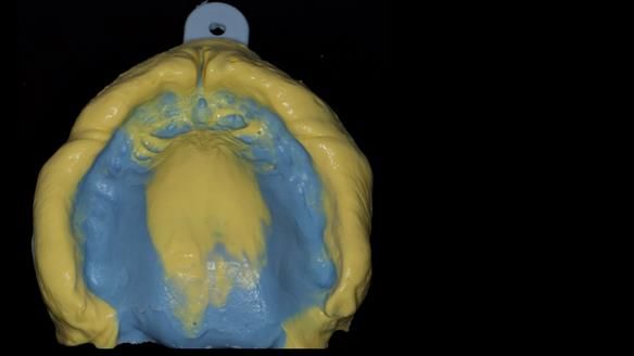 Newsletter 79 – Creating a wonderful smile and changing a life.