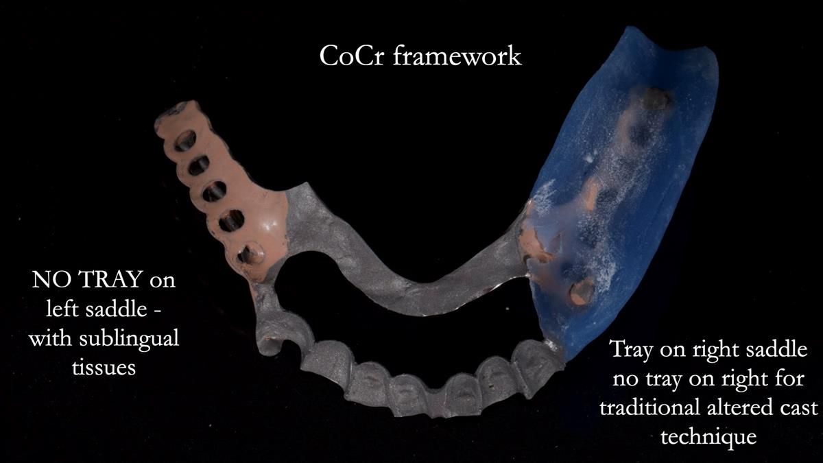 Newsletter 87 – Father Peter: A Partial Denture that needed Minor Miracle
