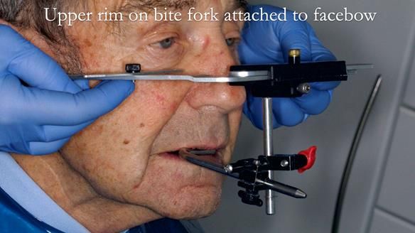 Newsletter 50 Special edition Complete Dentures FULL PROTOCOL