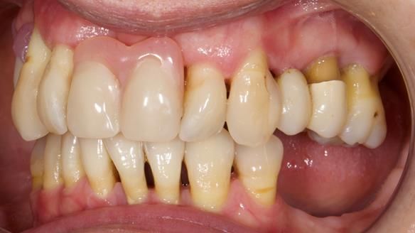 Newsletter 79 – Creating a wonderful smile and changing a life.