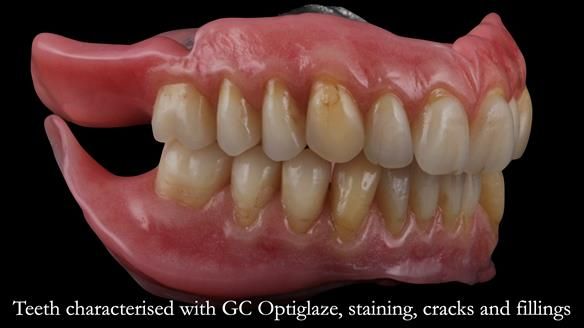 Newsletter 50 Special edition Complete Dentures FULL PROTOCOL