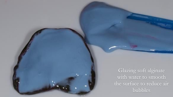 Newsletter 83: Sheila’s Complete Denture Success