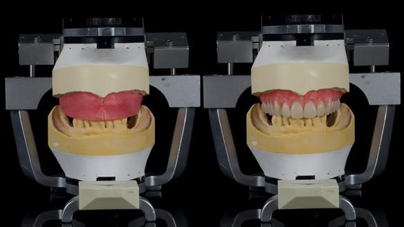 Newsletter 79 – Creating a wonderful smile and changing a life.