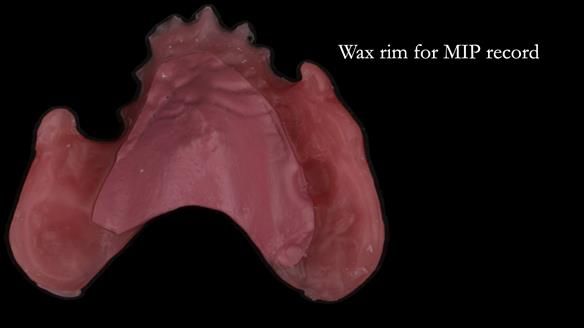 Ken – going downhill, first class