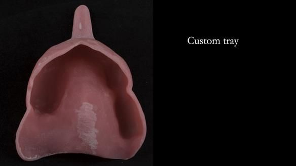 Ken – going downhill, first class