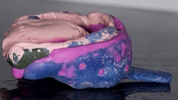 Newsletter 79 – Creating a wonderful smile and changing a life.