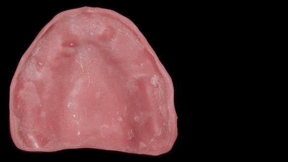 Newsletter 79 – Creating a wonderful smile and changing a life.